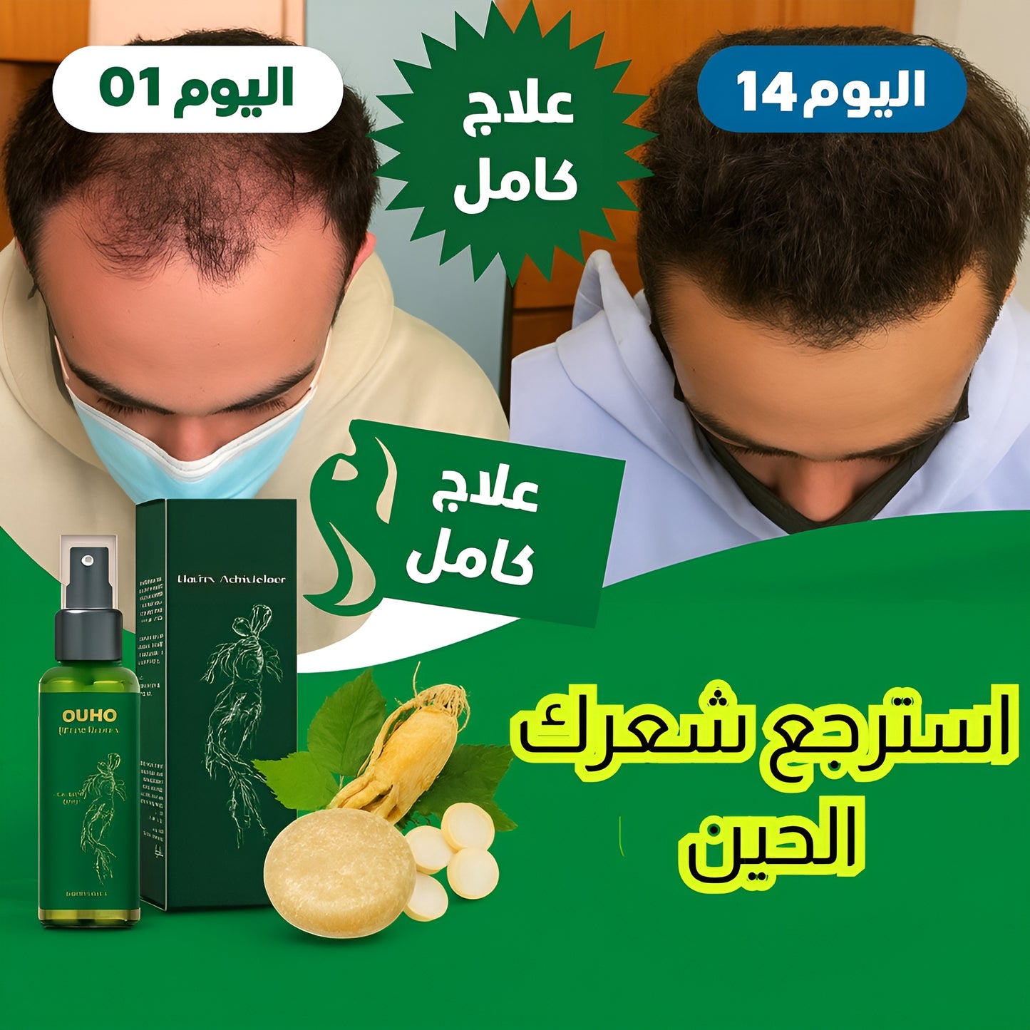 بخاخ الجينسنغ السحري: قنبلة تنشيط تفجّر شعرك قوة، كثافة، وثقة خيالية!